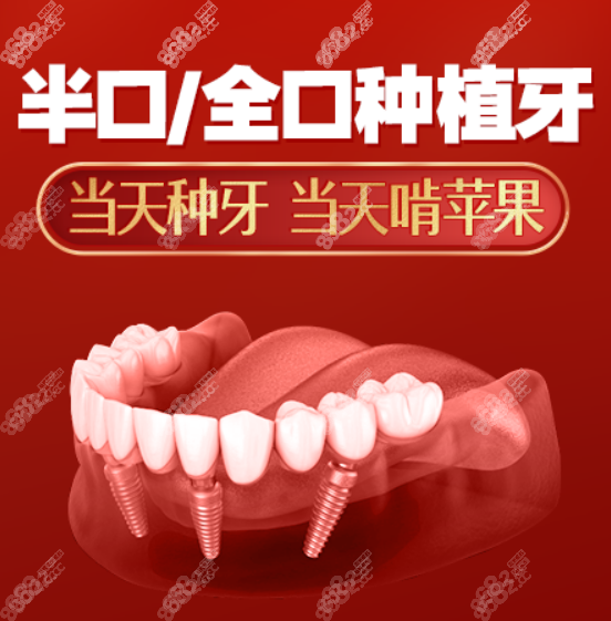 北京中诺口腔医院种植牙价格表2023年