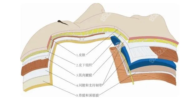 面部拉皮的剥离范围8682.cc