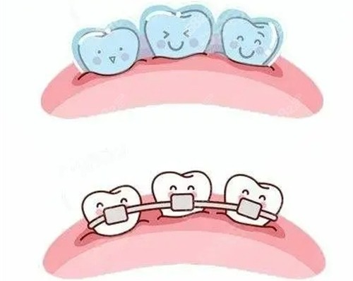 深圳麦芽口腔牙齿矫正怎么样
