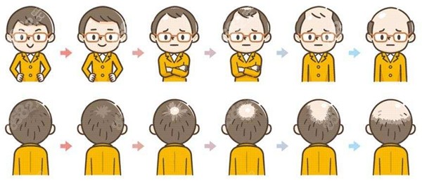 广州碧莲盛植发医生团队 8682.cc