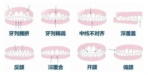 成都新桥口腔看牙贵吗？