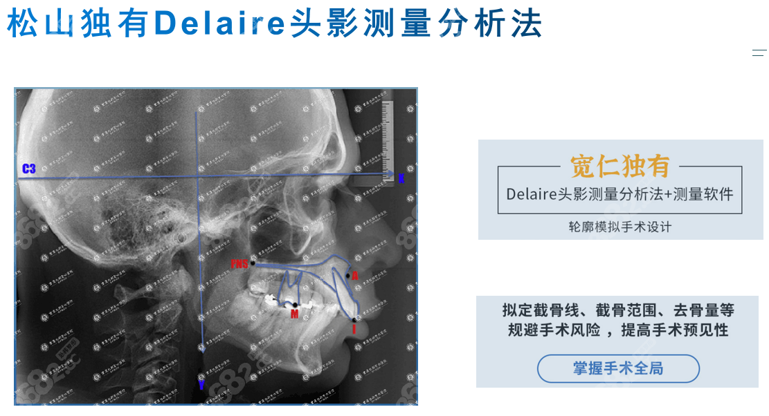 重庆<!--<i data=20240705-sp></i>-->做正颌手术好m.8682.cc