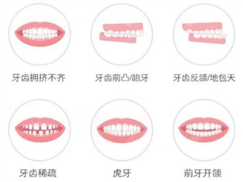 深圳穗华口腔正畸价格