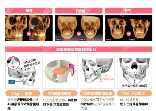 韩国欧佩拉整形外科