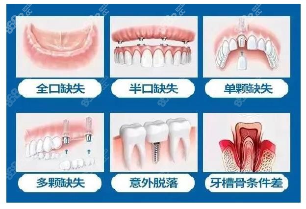 杭州上扬口腔如何预约看牙
