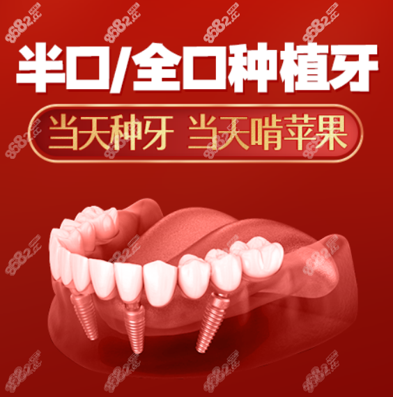 种植牙口腔医院费用2023