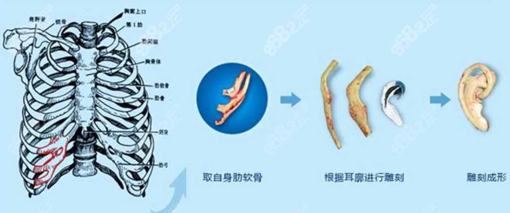 27岁还能做小耳再造吗