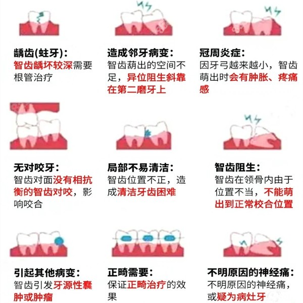 福州维乐口腔拔牙价格