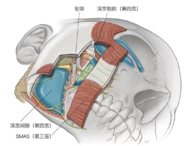 穆宝安面部拉皮结构示意图