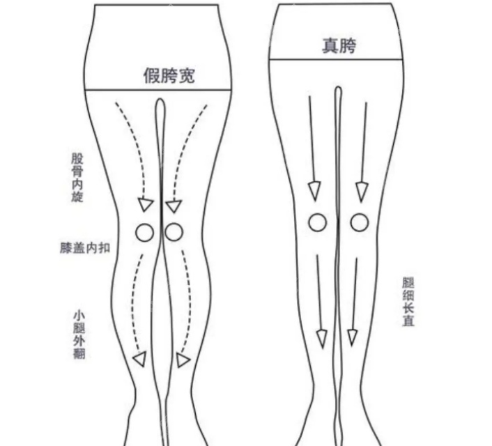 成都恒博天姿李烈o型腿矫正价格