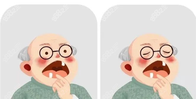 贵阳全口吸附假牙多少钱