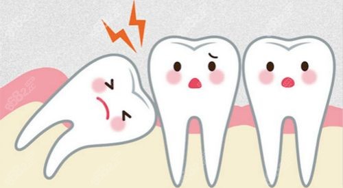 福州维乐口腔拔智齿价格