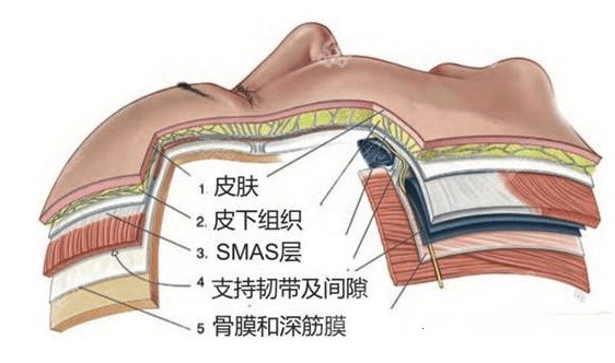 面部拉皮有什么后遗症或副作用吗？