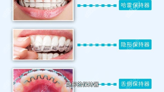 正畸后牙齿需要佩戴保持器