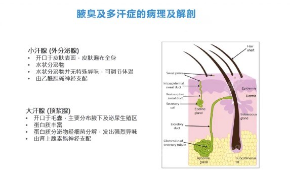 美国miraDry清新微波除腋臭原理