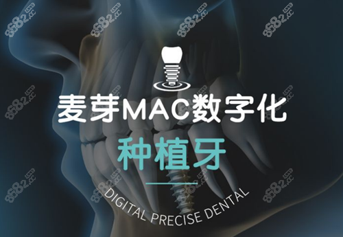 种植牙技术