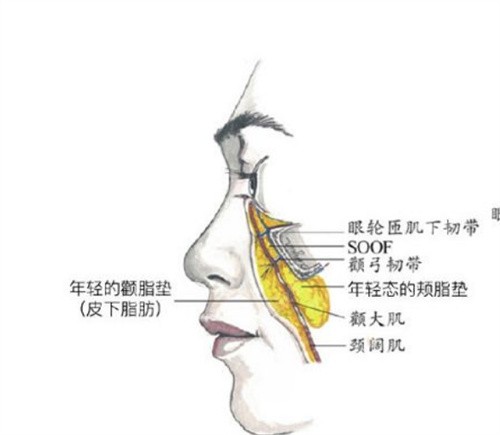 传统拉皮手术切口