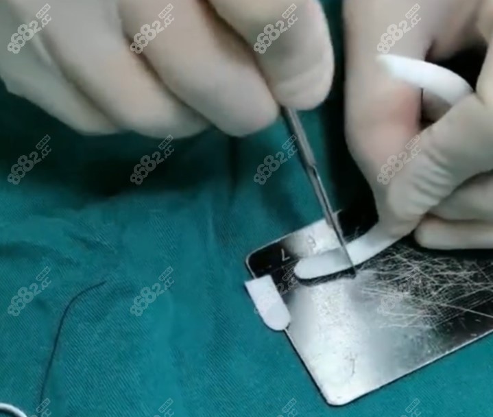 舒珀超肋在雕刻上考验医生技术8682.cc