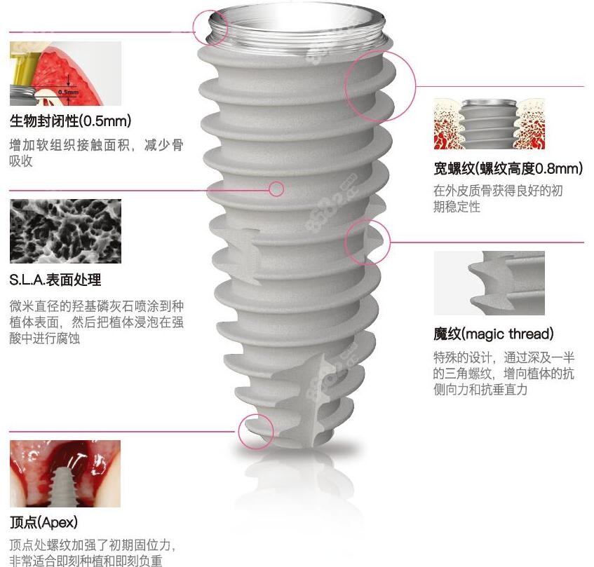 韩国纽百特种植体到底怎么样