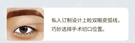 葛艳娜医生在面诊设计上优势