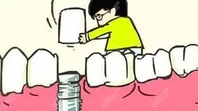 拔牙马上就能种牙吗