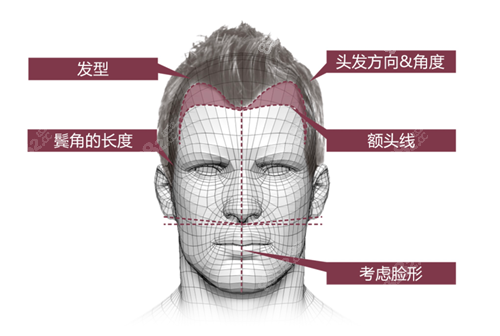 毛杰琳整形外科男士毛发移植