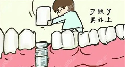镇江康洁口腔种植牙多少钱？