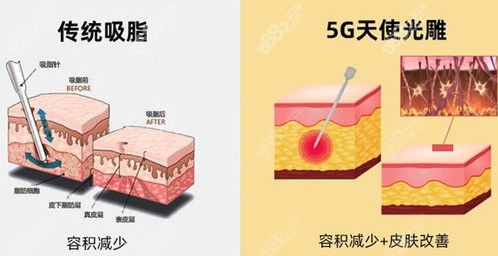 西安5g天使光雕医院地址www.8682.cc