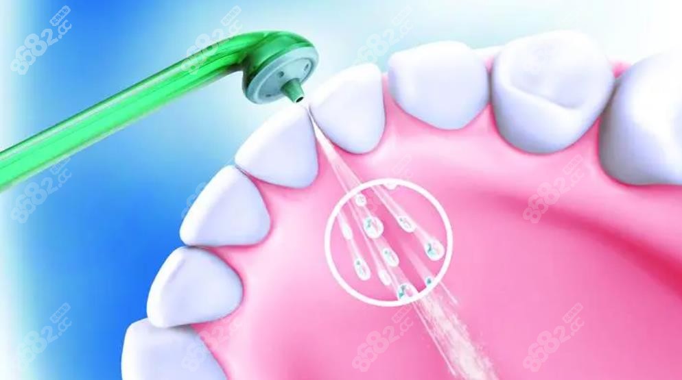 洗牙示意图8682.cc