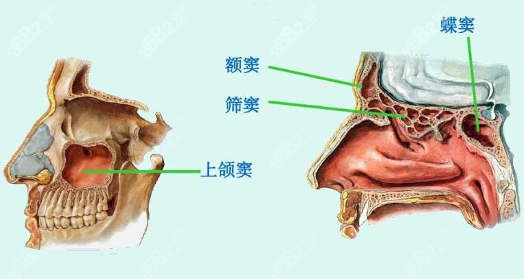 上颌窦穿透了会自愈吗8682.cc