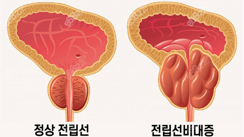 韩国世檀塔男科医院男科项目