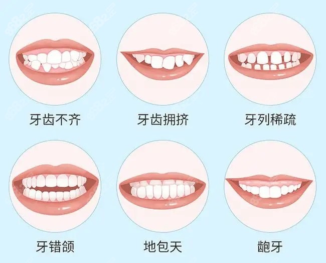 <!--<i data=20240705-sp></i>-->口腔牙齿矫正8682.cc