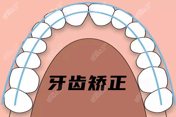 成都军大口腔医院矫正牙齿怎样