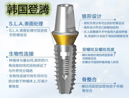 长沙美奥口腔韩国登腾种植牙价格