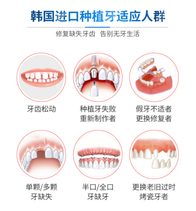 阜阳口腔医院种植牙价格