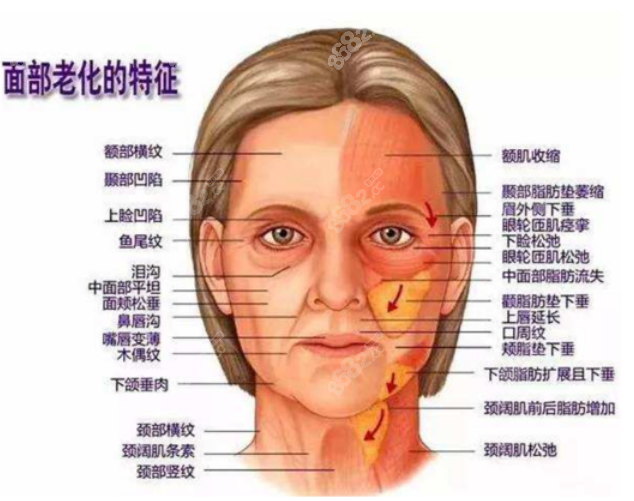 V美减龄手术医生在线咨询