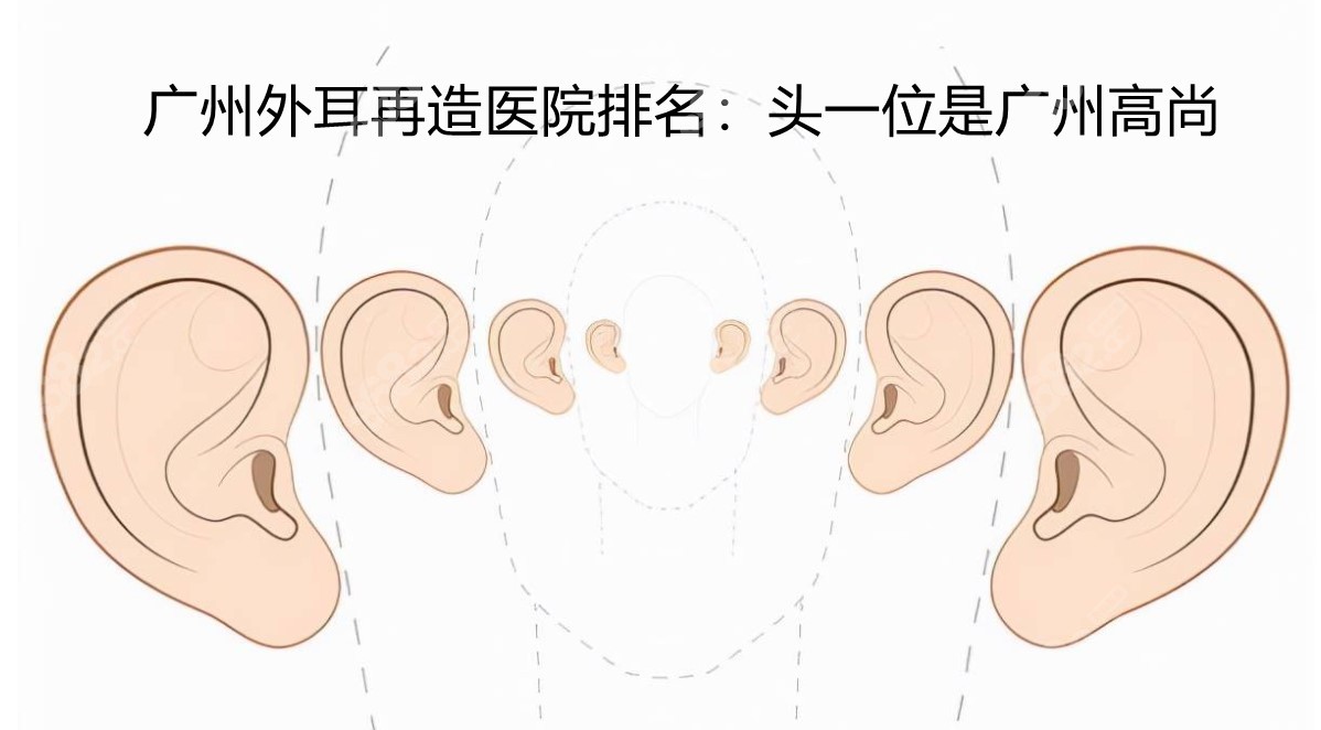 广州外耳再造医院排名头一位：广州高尚医疗美容 8682.cc