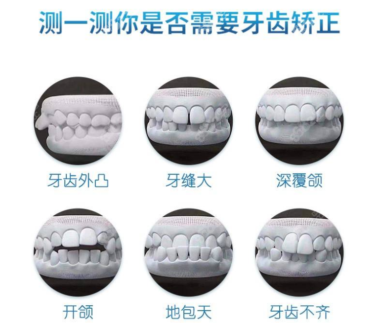 阜阳口腔医院正畸价格表