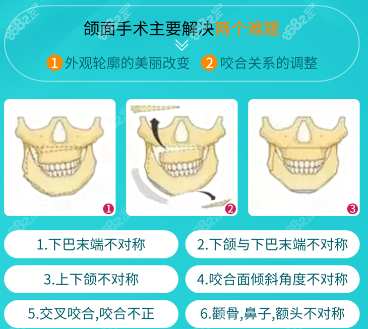 广州广大医院双鄂手术解决问题图解