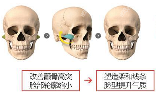 重庆当代安可忍做轮廓技术好m.8682.cc