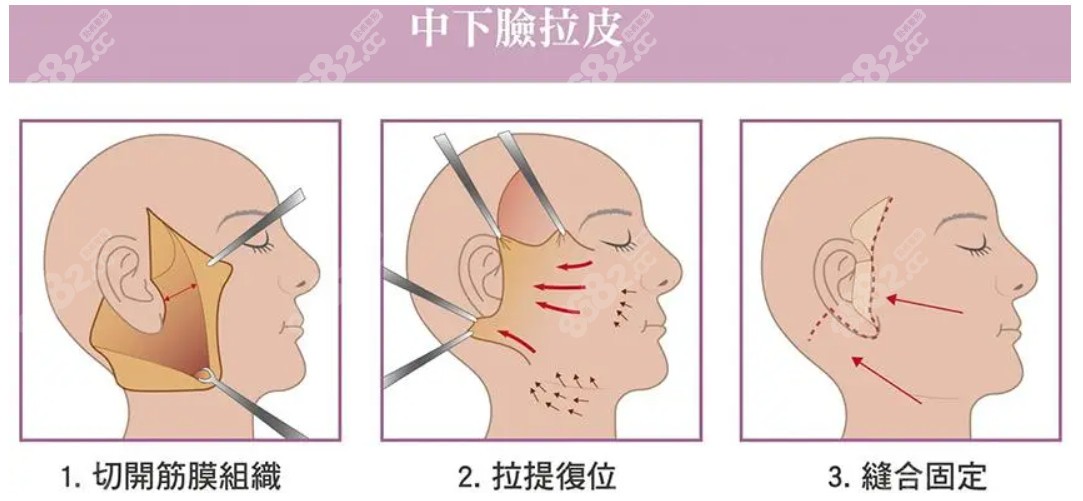 韩国十大拉皮出名的整形医院排名