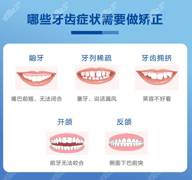 沈阳欢乐口腔正畸价格表8682.cc