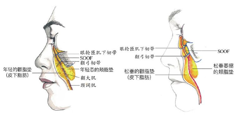 黄广香面部拉皮手术做得如何