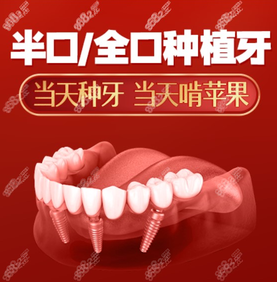 北京中诺口腔医院全口种植牙价格