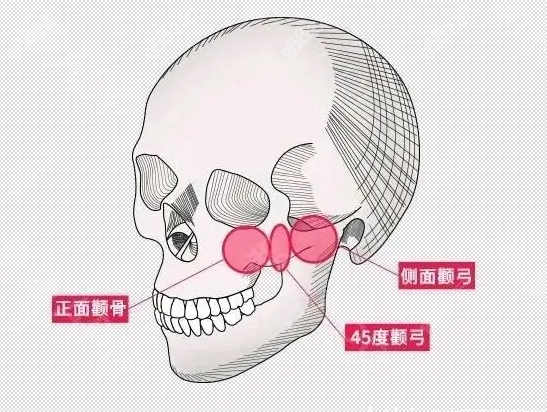 颧骨部位图示8682.cc