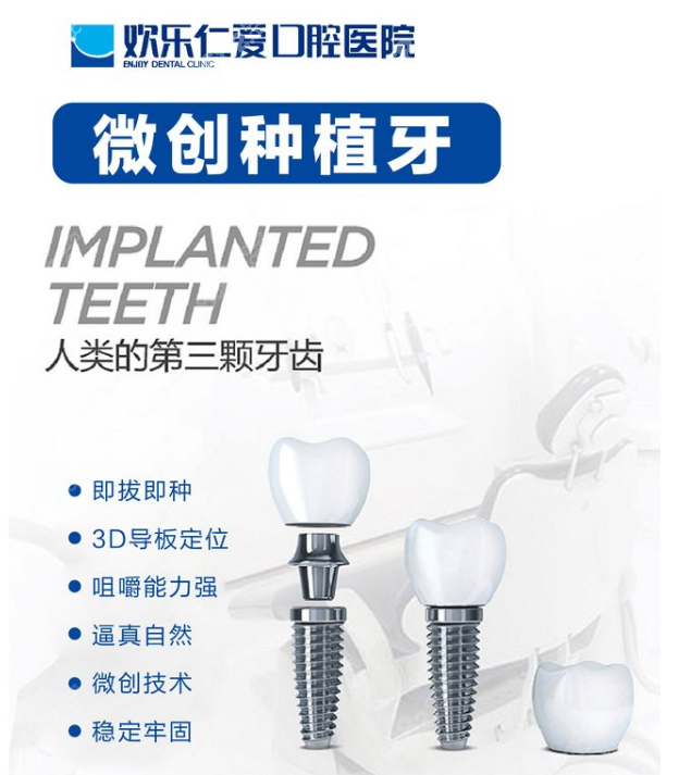 沈阳欢乐口腔种植牙价格