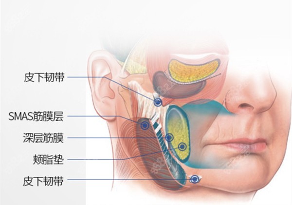 非手术SMAS面部提升术8682.cc