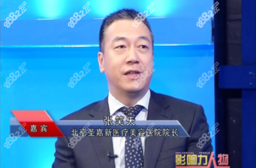北京圣嘉新张笑天院长