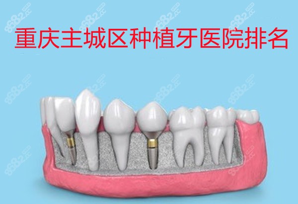重庆主城区种植牙医院排名