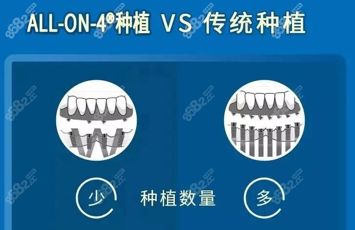 万州全口种植牙多少钱m.8682.cc